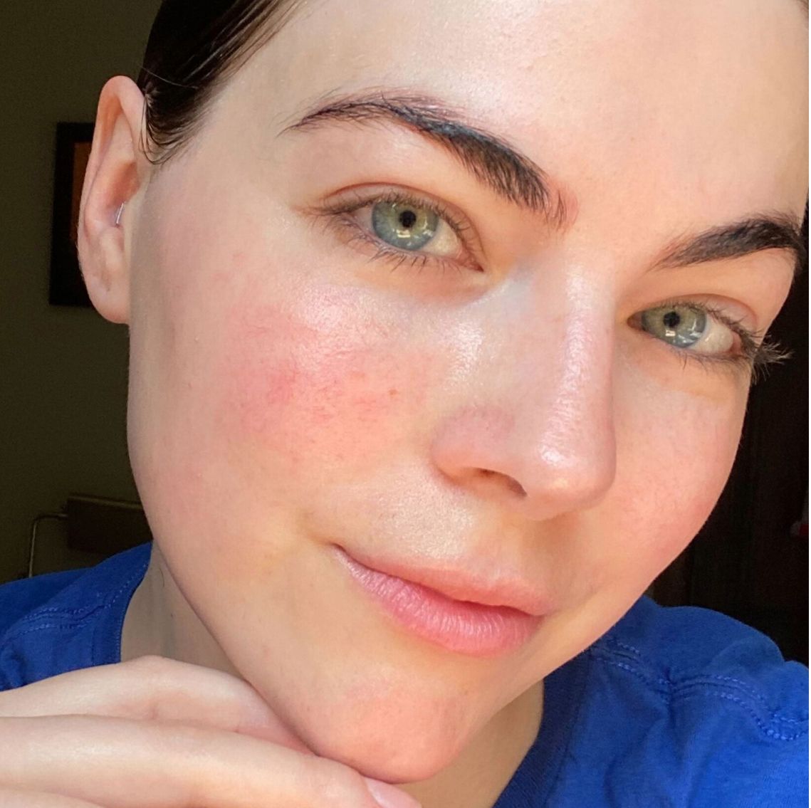 5 Best Korean Sunscreens to Complete Your Glass Skin Routine