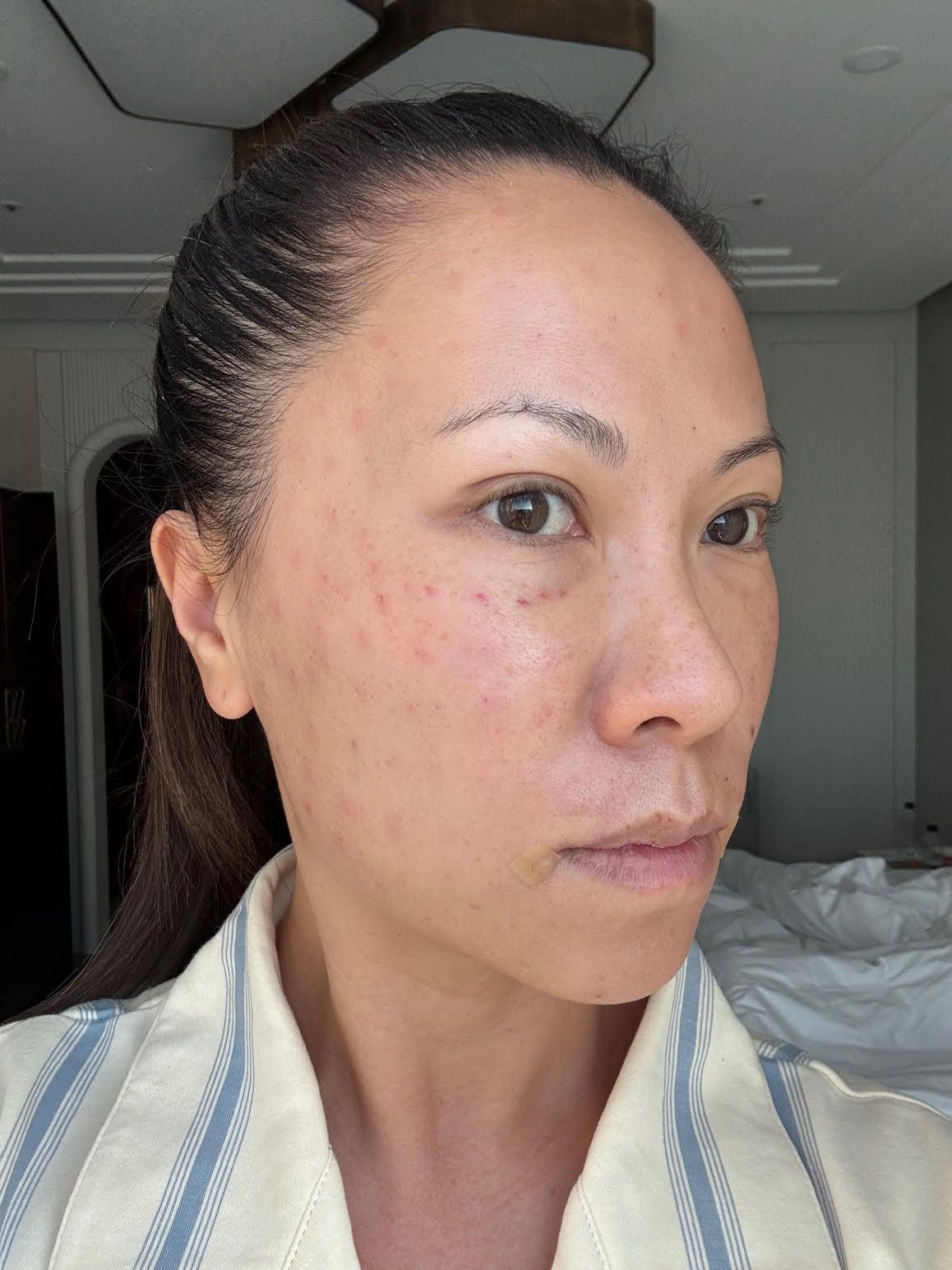 Image may contain Person Skin Adult Face Head Body Part and Neck